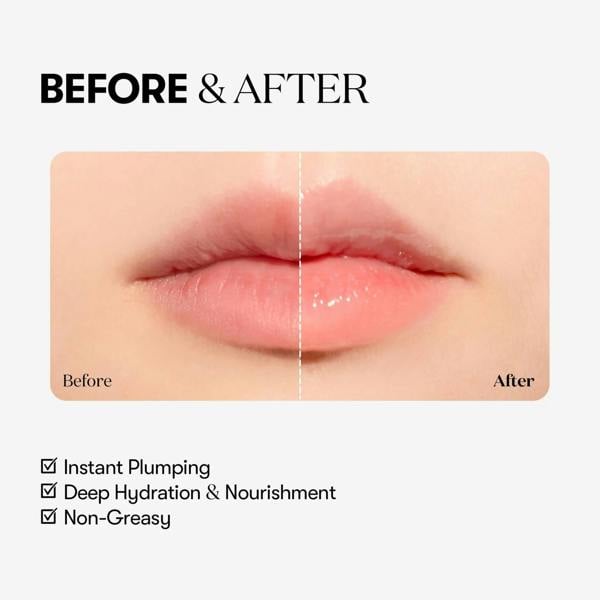 VT COSMETICS Reedle Shot Lip Plumper – Beginner