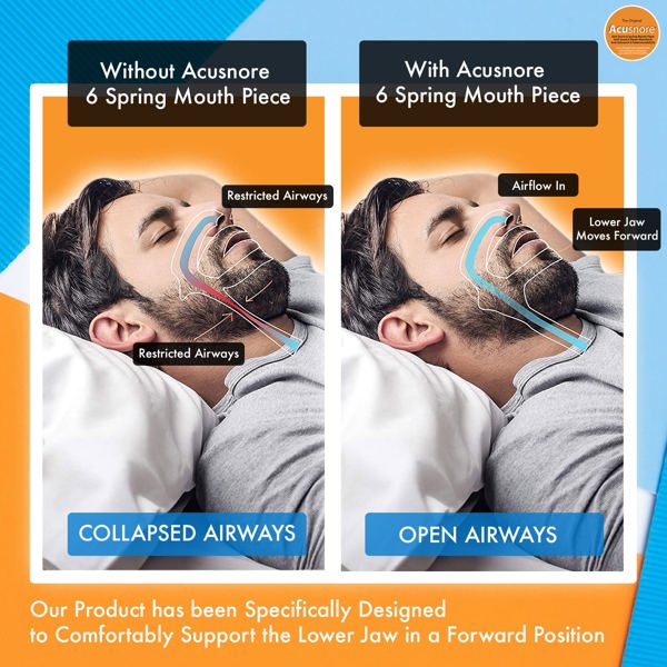 Acusnore Anti Snore Snoring Kit (Anit Snore Ring, Mouthpiece & Nose Clip)