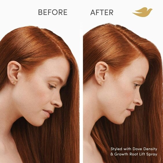 Dove Scalp+ Hair Therapy Hair Spray - Density & Growth Root Lift Spray, 12x100ml