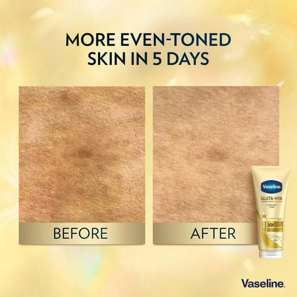 Vaseline Gluta-Hya Lotion Overnight Radiance & Flawless Glow, 200ml Each