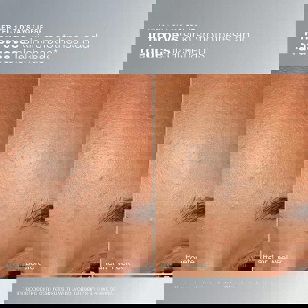 Dermalogica Daily Microfoliant Exfoliator