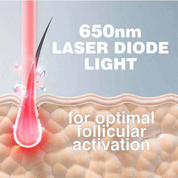 Illustration shows the Rio HairGrow Laser Head Band’s 650nm laser diode light targeting hair follicles, highlighting the power of red light therapy for effective hair regrowth over a microscopic view of skin tissue.