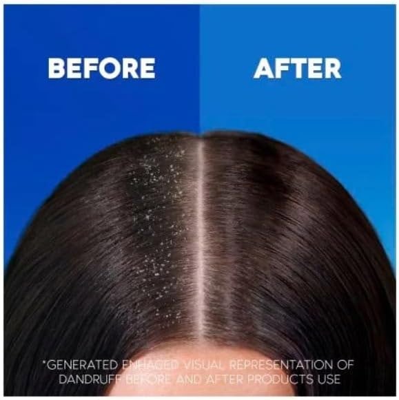 Head & Shoulders Anti-Dandruff Citrus 2in1 Shampoo 400ml Pack of 6