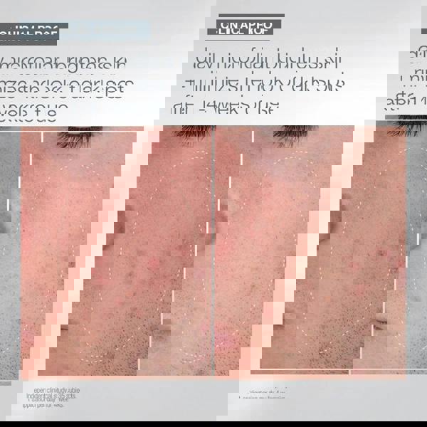 Dermalogica Warmth Of The Winter Sun