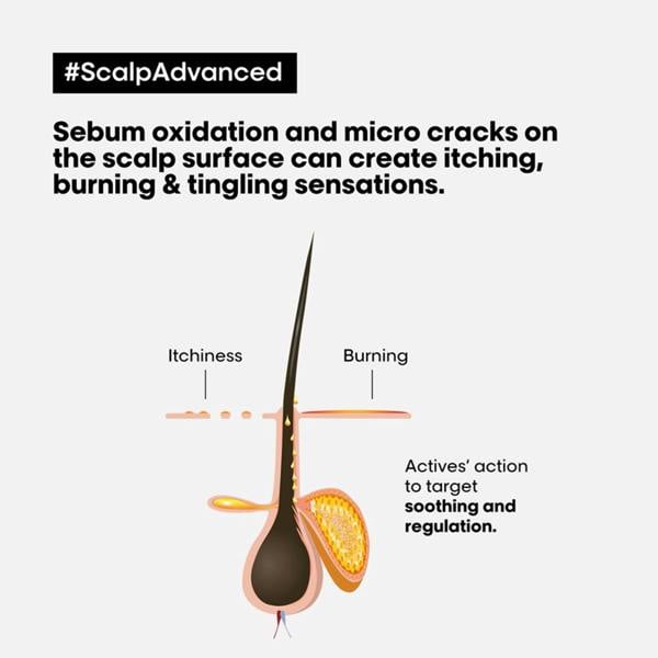 L'Oréal Professionnel&nbsp; Scalp Advanced Anti-Discomfort Treatment