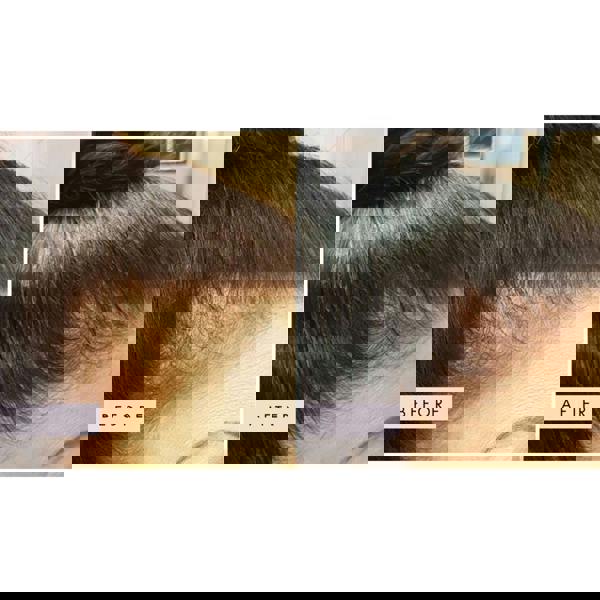 Hair Gain Gummies Duo - 2 Month Supply x 120 Gummies - Additional 4