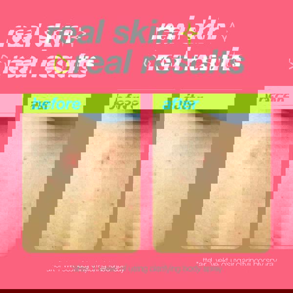 Dermalogica Clear Start Body Spray