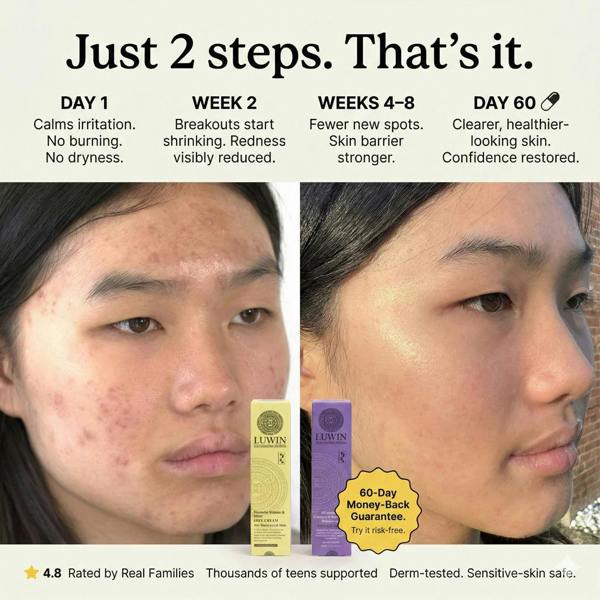 LUWIN Skincare Advanced Calming & Clear Duo – Acne Cream & Calming Mist Set for Clear Skin | LUWIN