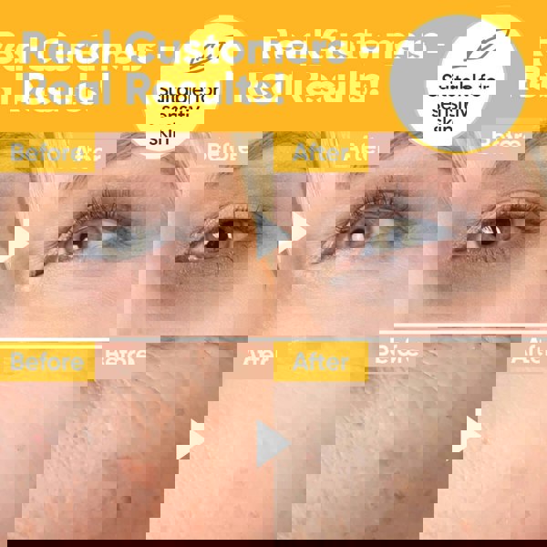 Âme Pure RETINOL & VITAMIN C - Plant-Based Retinol, Brightening & Skincare Serum For Face