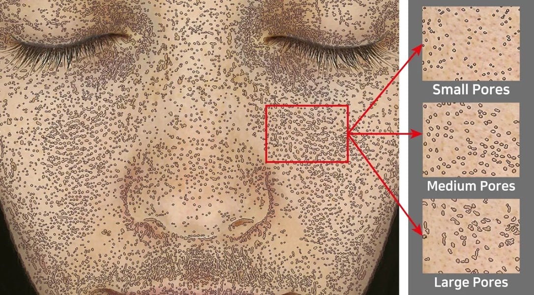 Pure Tone Mark-Vu Digital Photographic Skin Analysis Machine Pure Tone Aesthetics