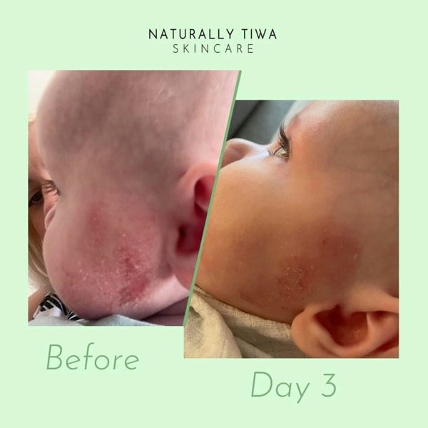 Naturally Tiwa Skincare YARA Body Food 250ml sensitive skin, eczema, psoriasis, rosacea, skin undergoing chemotherapy and radiotherapy and dry skin conditions.