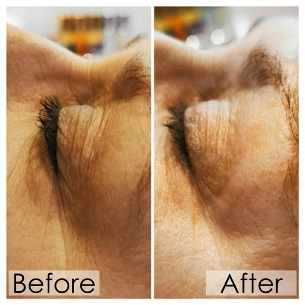 elixir SK9 bio-serum