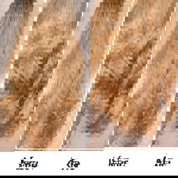 before and after hair growth treatment