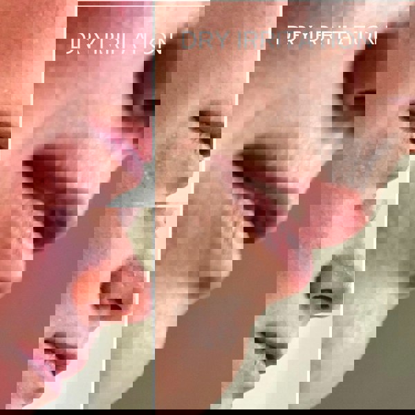 Rescue Serum Before and After image showing inflamed red skin, next to a sooothed, healthy. complexion.