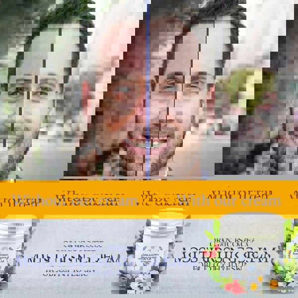 Rosacea cream organic product