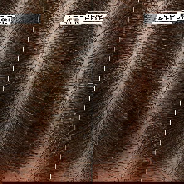 Philip Kingsley Conditioner Flaky/Itchy Scalp 1000ml - Additional 7