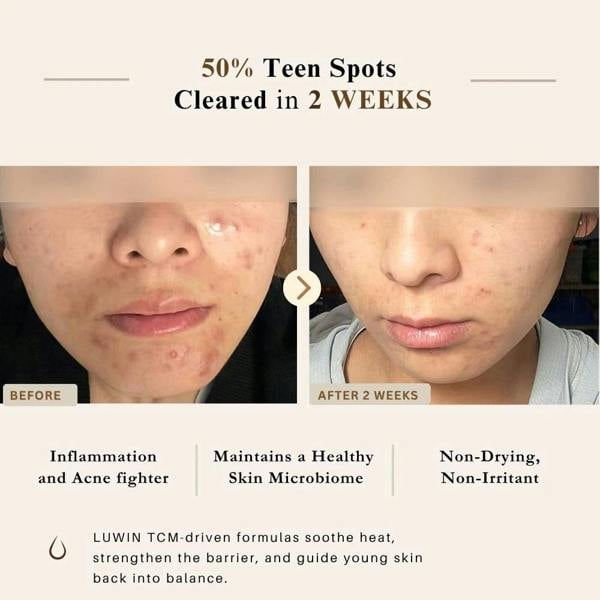 LUWIN Skincare Ultimate Repair & Clear Face Cream – Calming Acne Cream for Acne-Prone Skin | LUWIN
