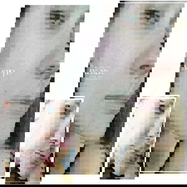 Âme Pure CIT FACE ROLLER PLATINUM - Microneedling Derma Roller Kit