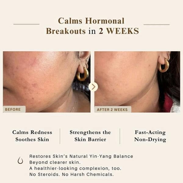 LUWIN Skincare Ultimate Repair & Clear Face Cream – Calming Acne Cream for Acne-Prone Skin | LUWIN