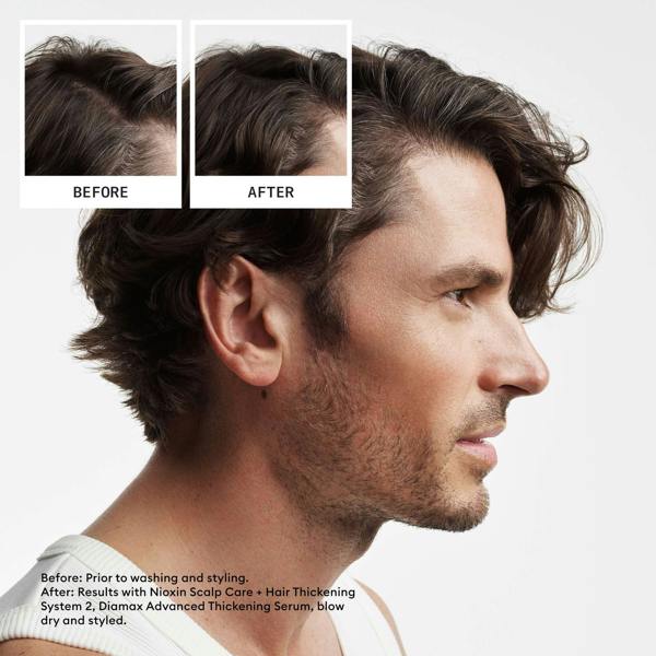 Nioxin Pro Clinical Gifts & Sets System 2 Trial Kit for Natural Hair with Progressed Thinning - Additional 5