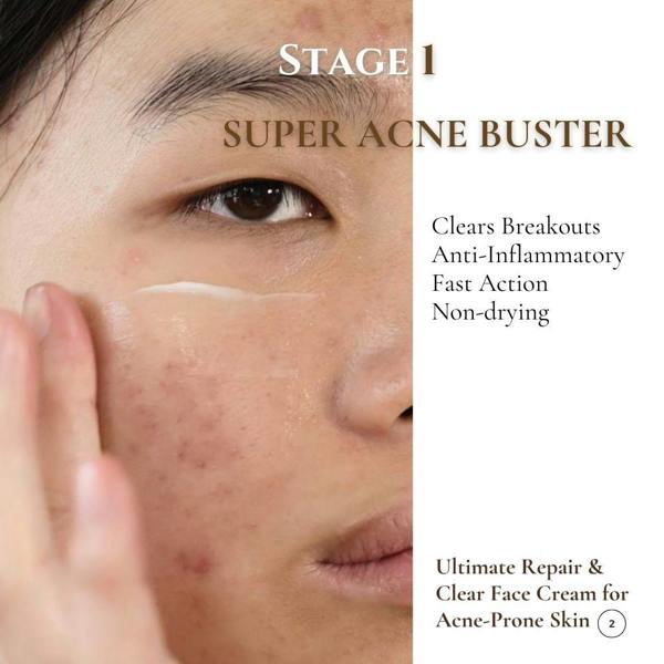 Luwin Advanced Clear & Brightening Super Set