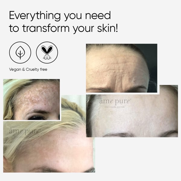 Âme Pure WRINKLERASER BASIC - Microneedling Derma Roller Kit