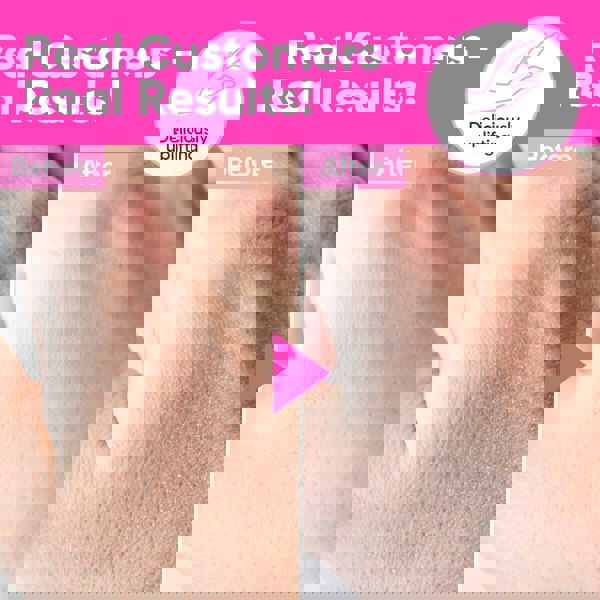 Âme Pure SUPER-SMOOTHING HAND CREAM - For Dry Hands With Vitamin E