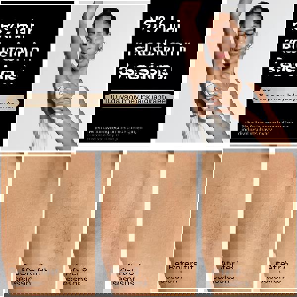 Braun IPL Silk·expert Pro 5, At Home Hair Removal, 4 Attachment Heads, PL5441