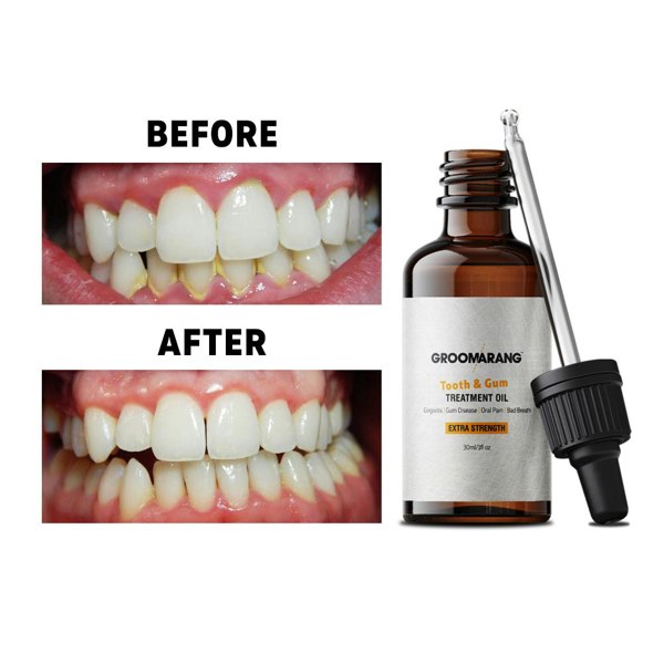 Groomarang Extra Strength Tooth & Gum Treatment Oil 30ml