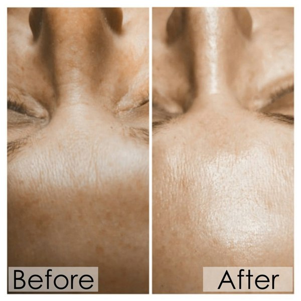 elixir SK9 bio-serum