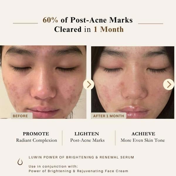 LUWIN Skincare Ultimate Brightening & Rejuvenating Complete Set – Full Hyperpigmentation & Dark Spot Routine | LUWIN