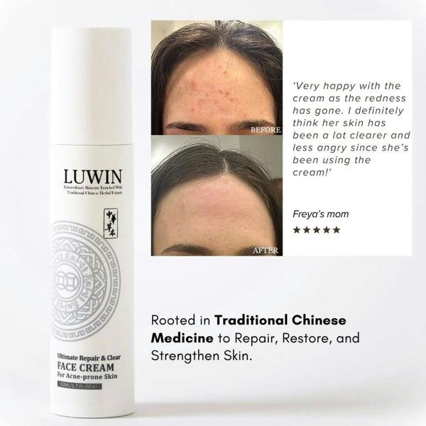 LUWIN Skincare Ultimate Repair & Clear Face Cream – Calming Acne Cream for Acne-Prone Skin | LUWIN