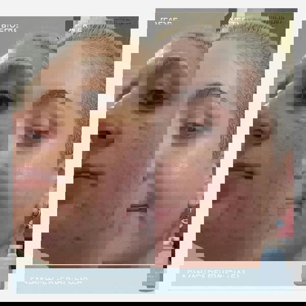 Vida Glow Clear Capsules