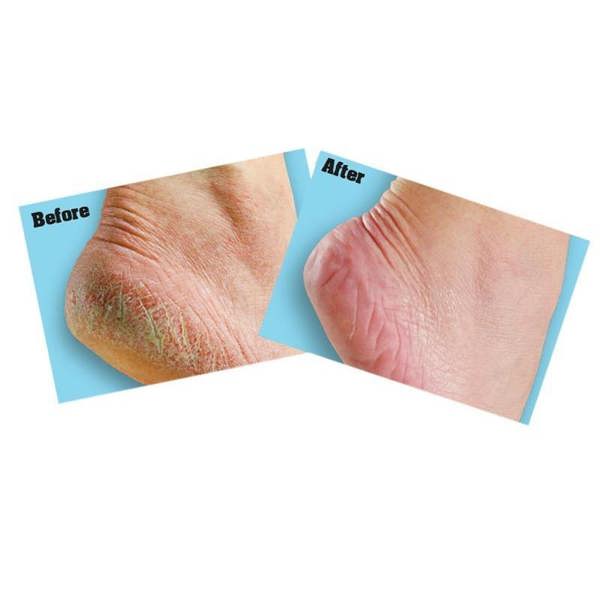 Gorilla Glue O'keeffe's Healthy Feet Foot Cream - Multi Colour - 