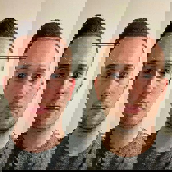 BeautyPro Tools & Accessories Photon LED Light Therapy Facial Mask - Additional 7