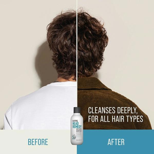 KMS HeadRemedy Deep Cleanse Shampoo 300ml
