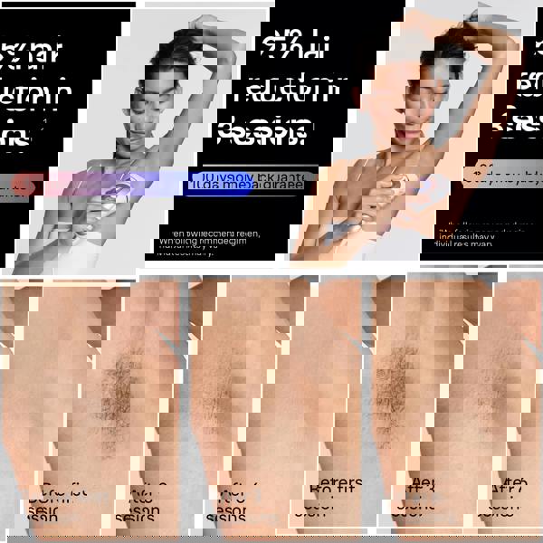 Braun Smart IPL Skin i·expert, At Home Hair Removal, With Free App, 2 Smart Heads, PL7211