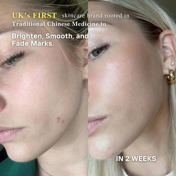 LUWIN Skincare Powerful Brightening & Rejuvenating Duo – Hyperpigmentation Cream & Brightening Serum Set | LUWIN