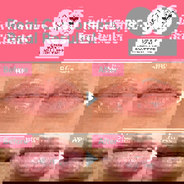 Âme Pure BERRY SMOOTH LIP BALM - Moisturizing Treatment For Extra Dry Lips