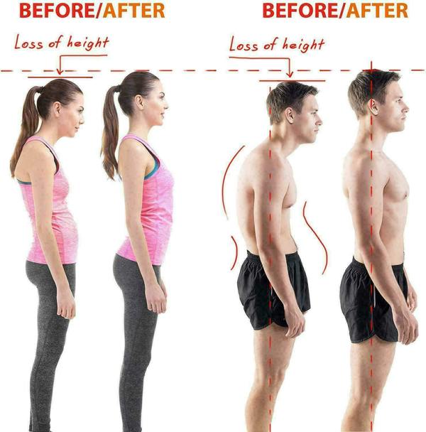 DYZI Posture Corrector for Men and Women -Medium/Large-Chest Size 36" to 46"