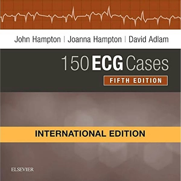 Elsevier 150 ECG Cases