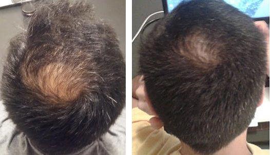 RESEED R8 Botanical Solution for Men 50 ml - Reseed Hair Loss Range for Men and Women
