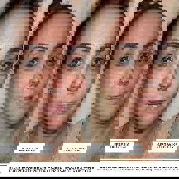 BeautyPro Tools & Accessories Photon Wand - Additional 6