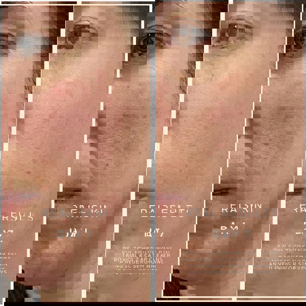 Raven Botanicals Soothing Superheroes - Cleanser & Rescue Serum