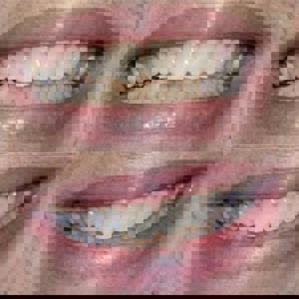 Smile Science Harley Street Organic Activated Charcoal Whitening Powder