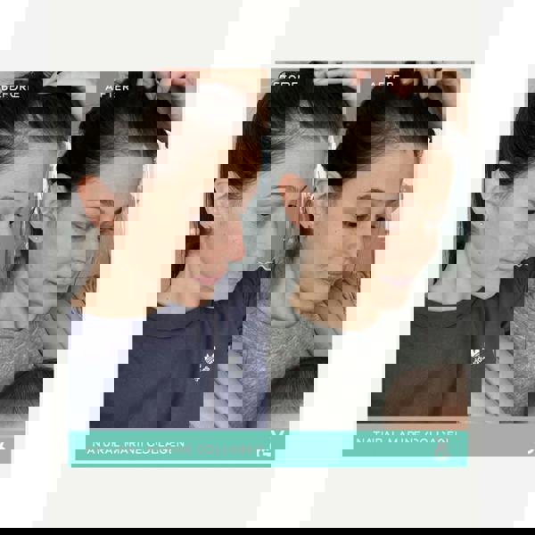 Vida Glow Mixed Natural Marine Collagen Collagen Trial