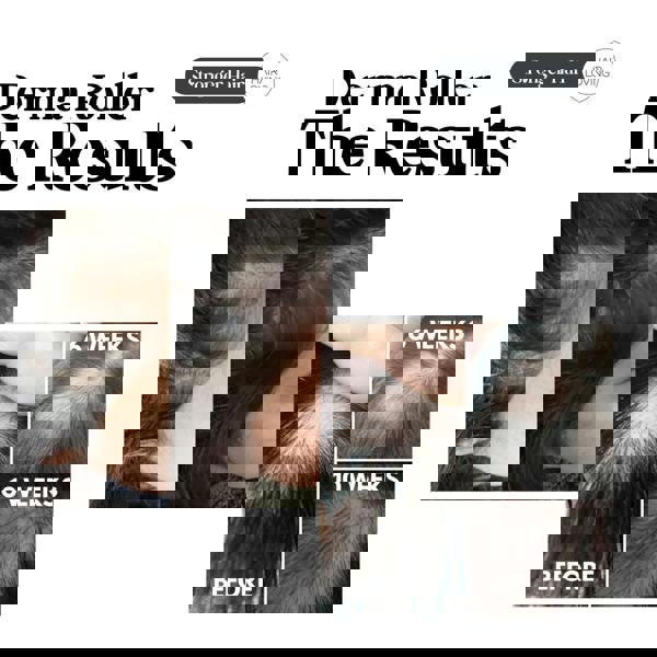 Hair Loving Derma Roller for Hair Growth – Stimulate Regrowth & Reduce Hair Loss Naturally