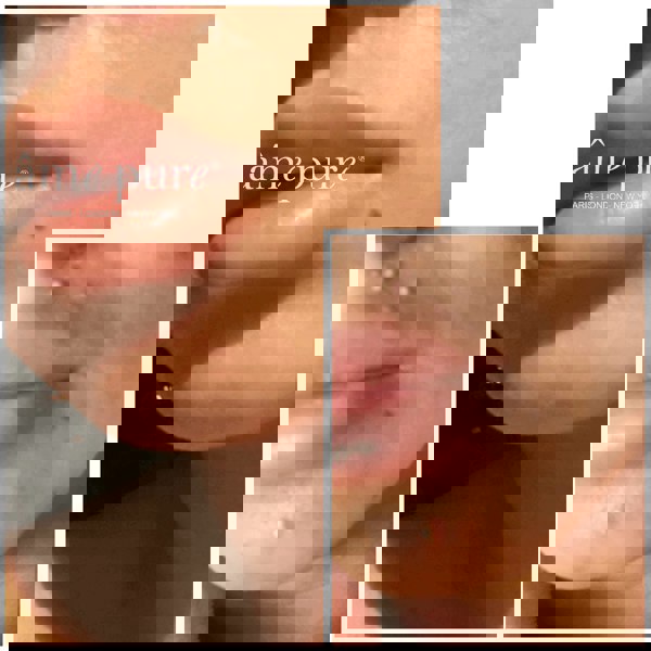 Âme Pure CIT FACE ROLLER PLATINUM - Microneedling Derma Roller Kit