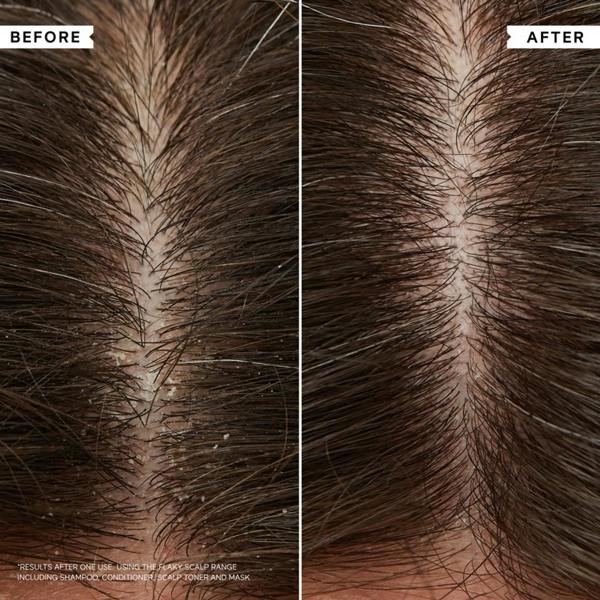 Philip Kingsley Hydrating AntiDandruff Shampoo Duo Duo