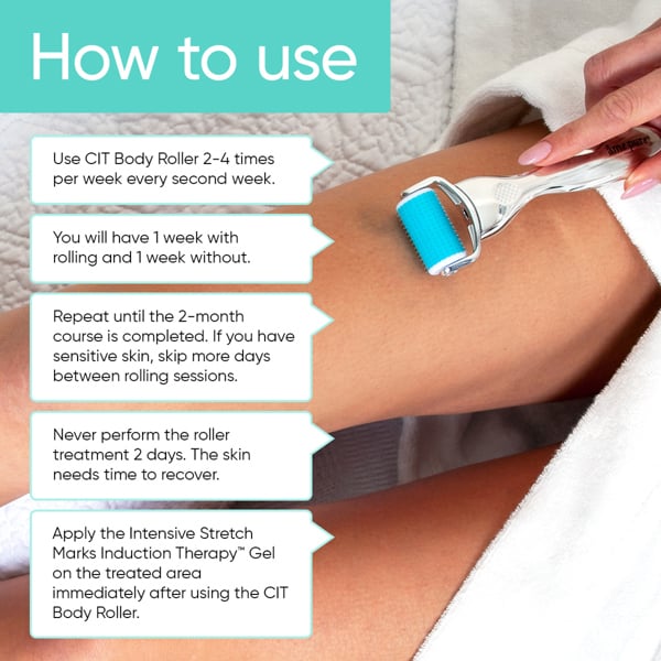 Âme Pure BODY BASIC | STRETCH MARKS – Microneedling Derma Roller Kit For Cellulite & Stretch Marks